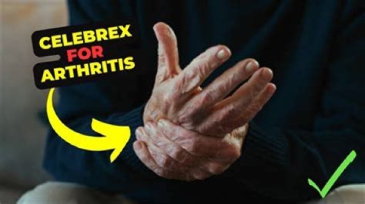 Does Celebrex work for arthritis?