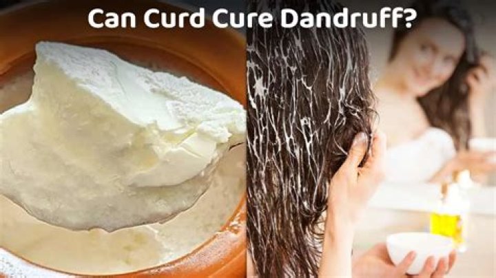 Does curd remove dandruff?