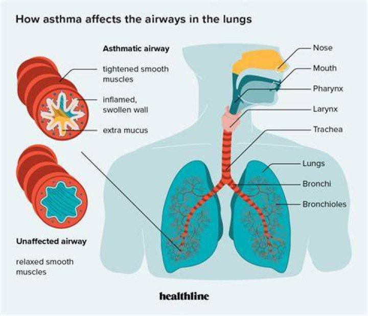 Does fresh air help asthma?