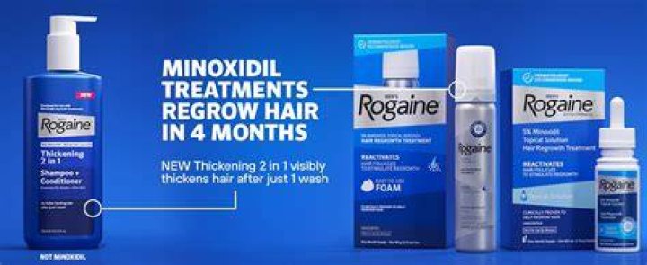 Does hair become dependent on minoxidil?