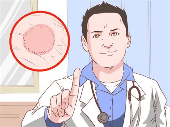 Does Sudocrem help itching?