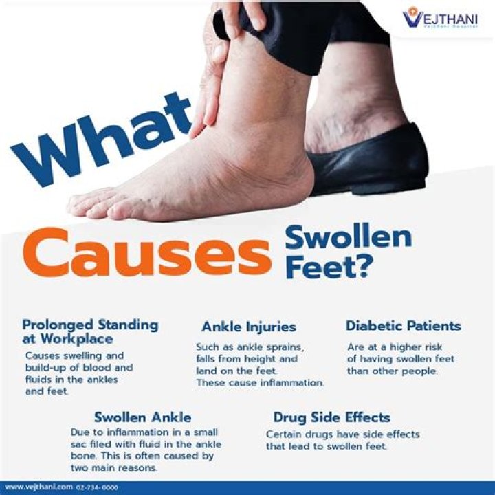 Does walking help swollen legs?