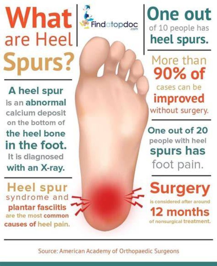 Does walking make heel spurs worse?