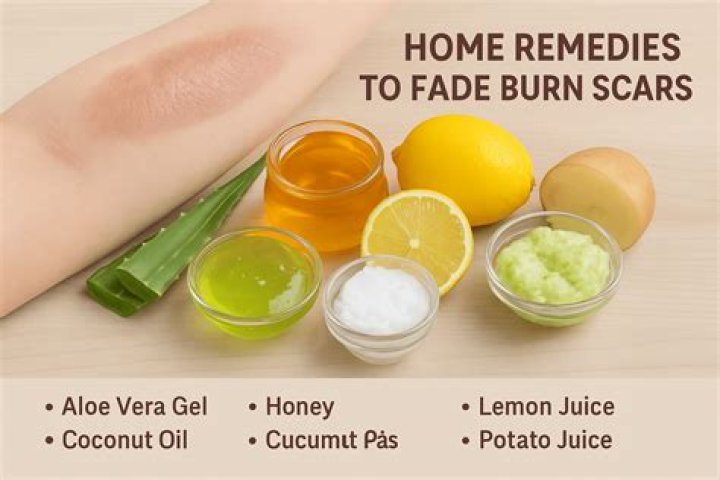 How can I get rid of burn marks on my face naturally?