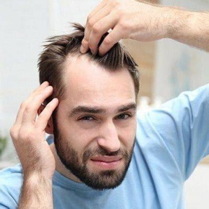 How can I regrow my frontal hairline?