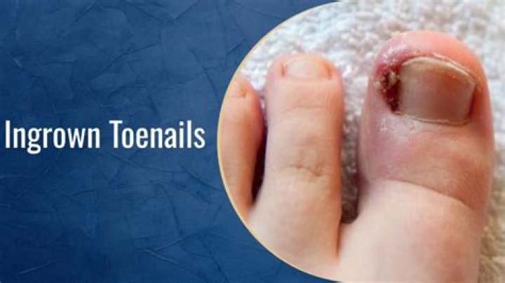 How can I stimulate my toenail growth?