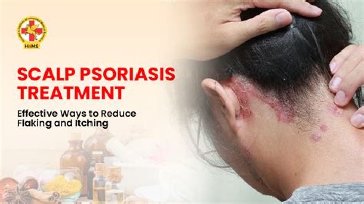 How can I stop my psoriasis from getting worse?