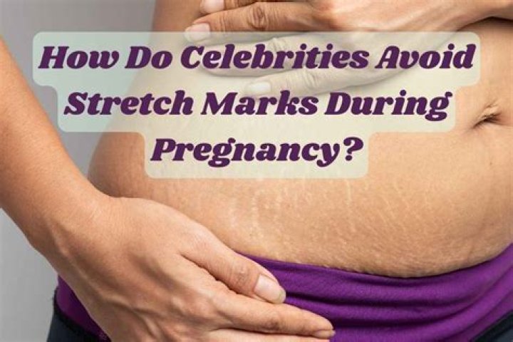 How do celebrities have no stretch marks after pregnancy?