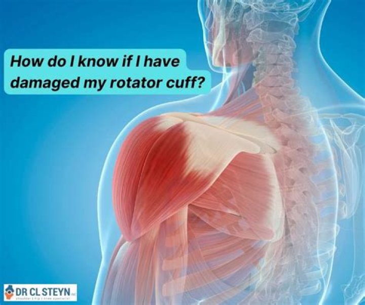 How do I know if I have damaged my rotator cuff?