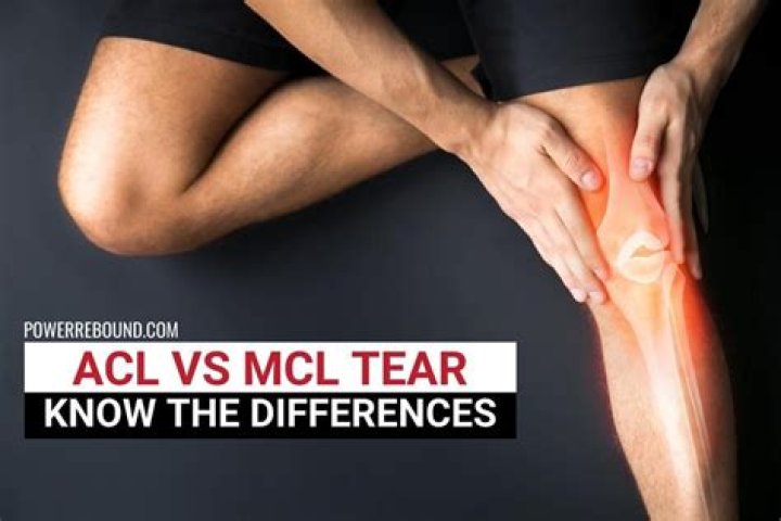 How do I know if I tore my MCL?
