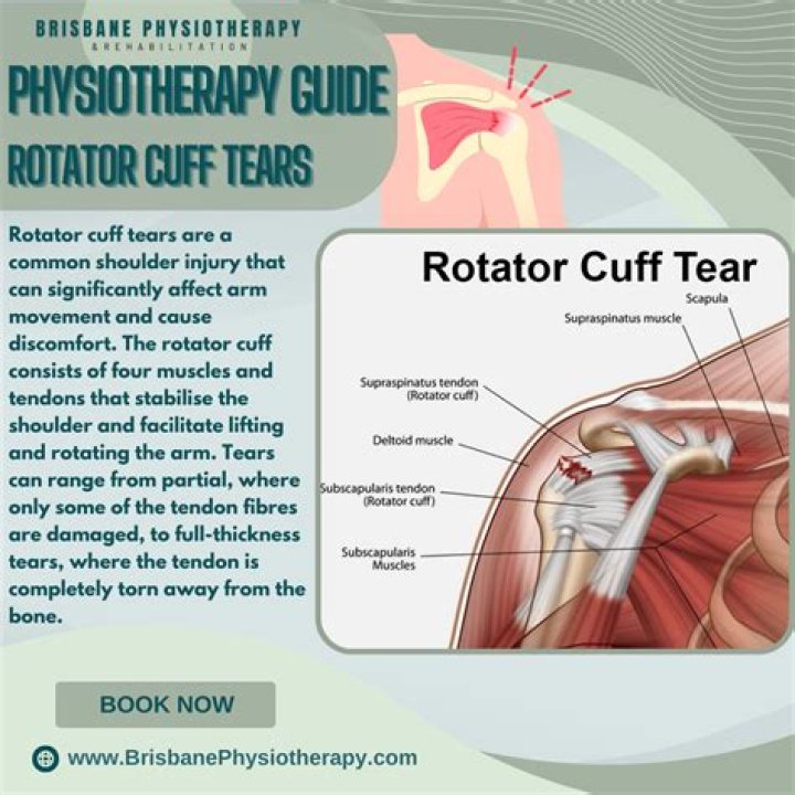 How do I know if I tore my rotator cuff?
