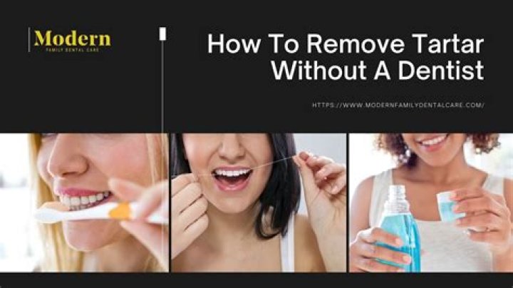 How do I remove tartar from my teeth without dentist Reddit?