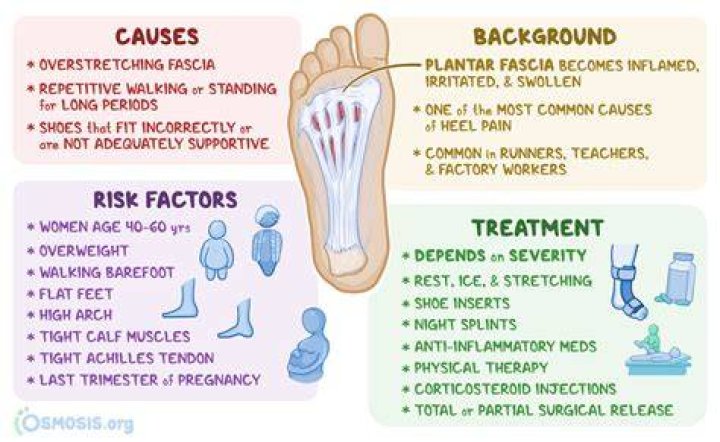 How do I sleep at night with plantar fasciitis?