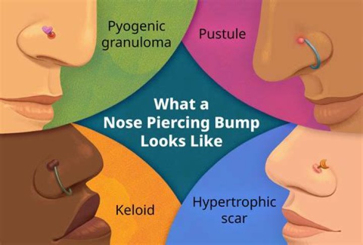How do I stop the side of my nose from smelling?