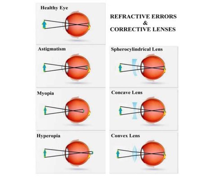 How do you correct farsightedness?