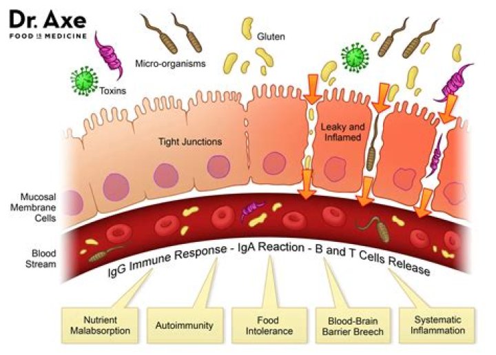 How do you fix a leaky gut?