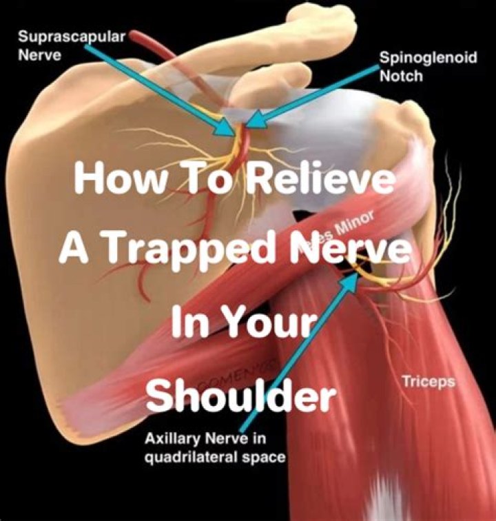 How do you fix nerve pain in your shoulder?