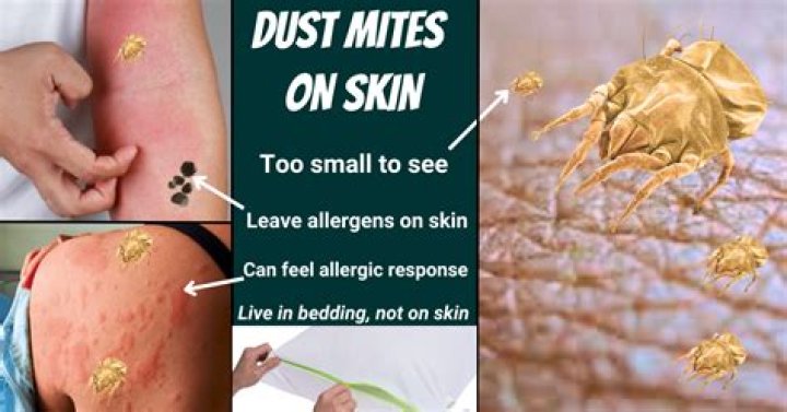 How do you get rid of skin mites?