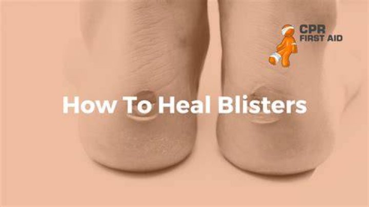 How do you heal a ripped blister?