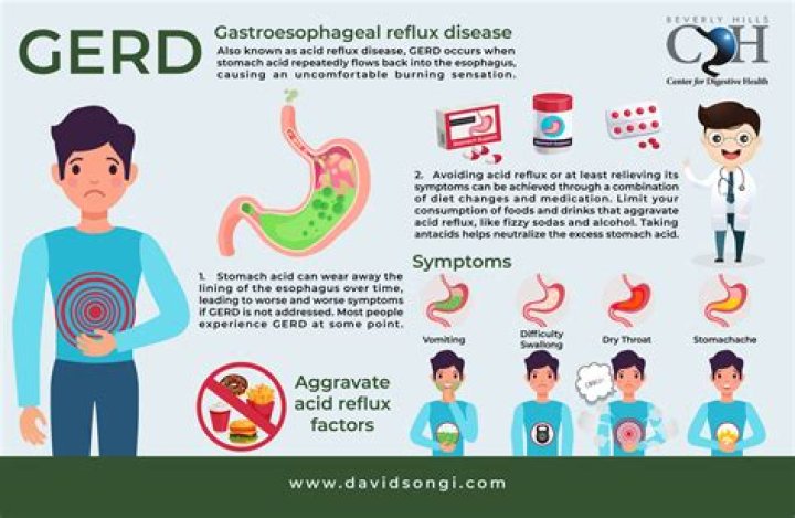 How do you know if your acid reflux is serious?