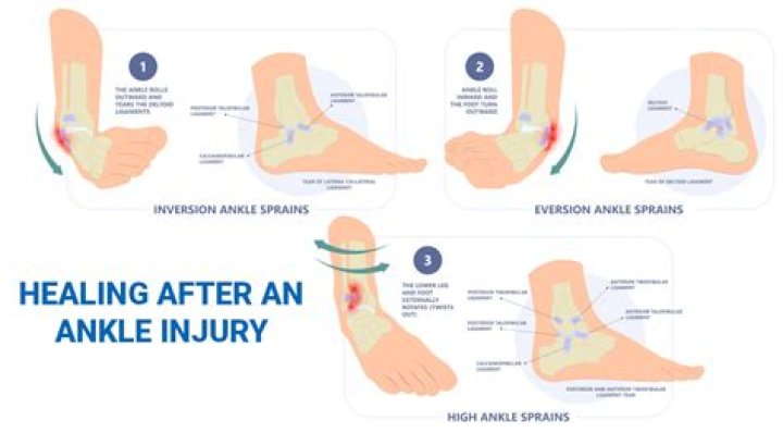 How do you know when sprained ankle is healed?