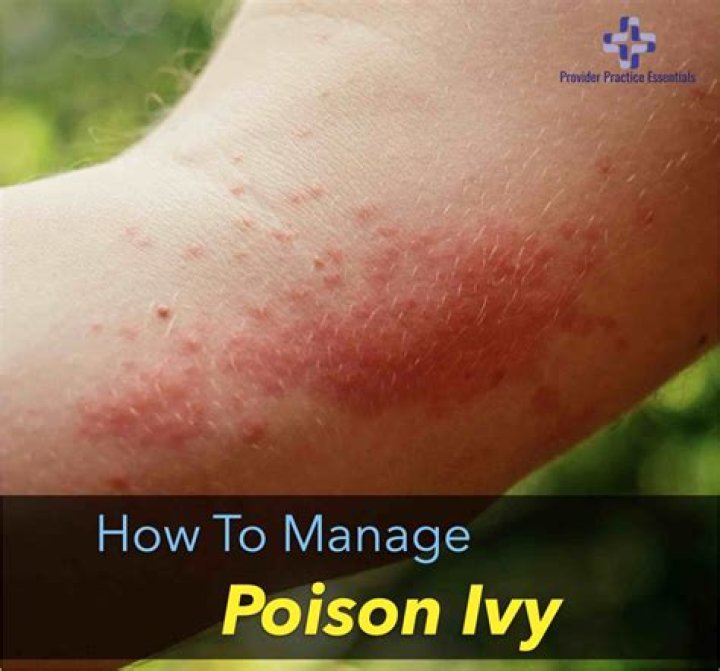 How do you poison a bird?