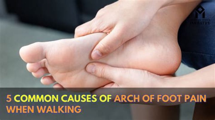 How do you release a tight arch in your foot?