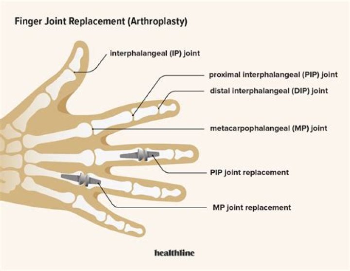 How do you reset finger joints?
