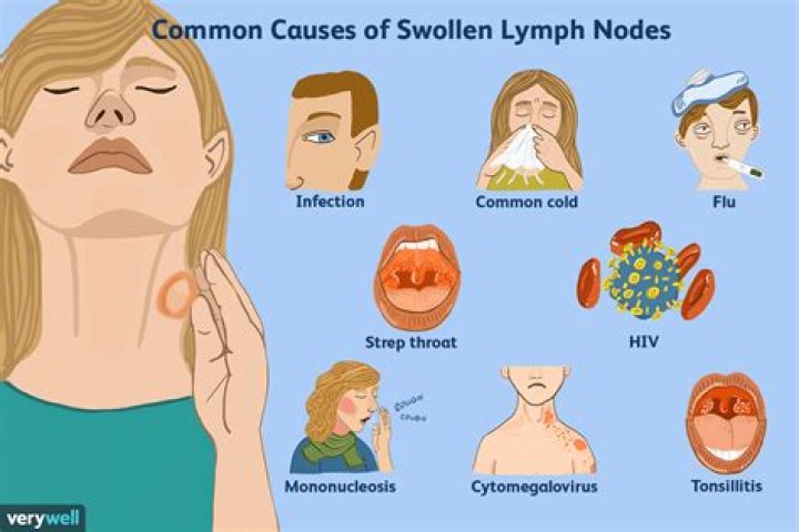 How do you tell if a lump is a lymph node?