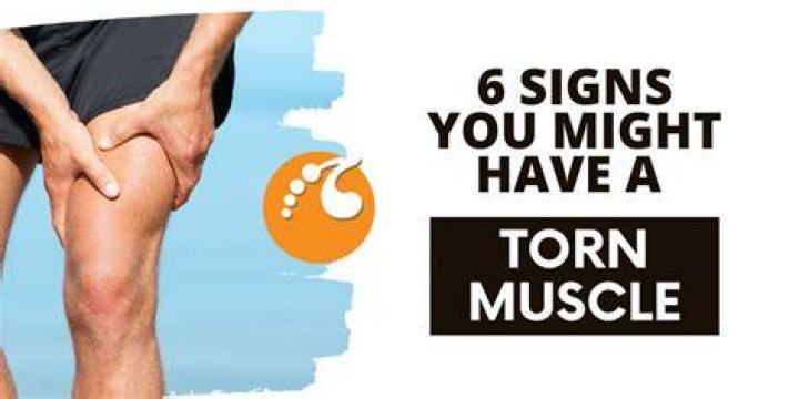 How do you tell if you have a torn muscle or ligament?
