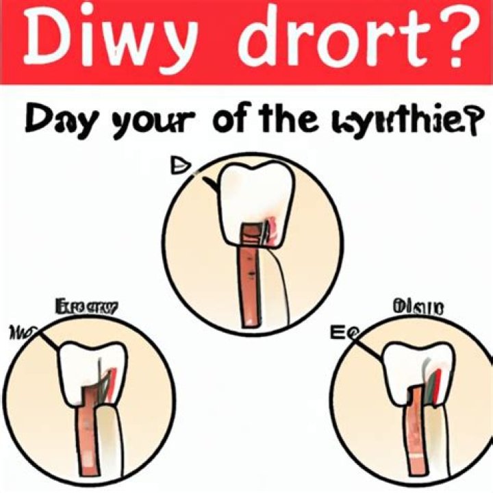 How does drinking from a straw cause dry socket?