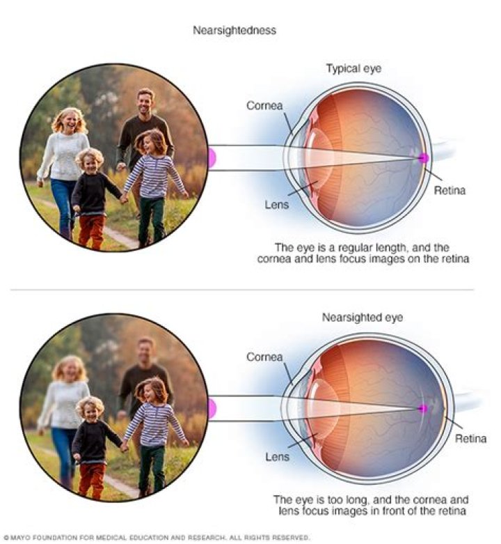 How far away can a nearsighted person see?
