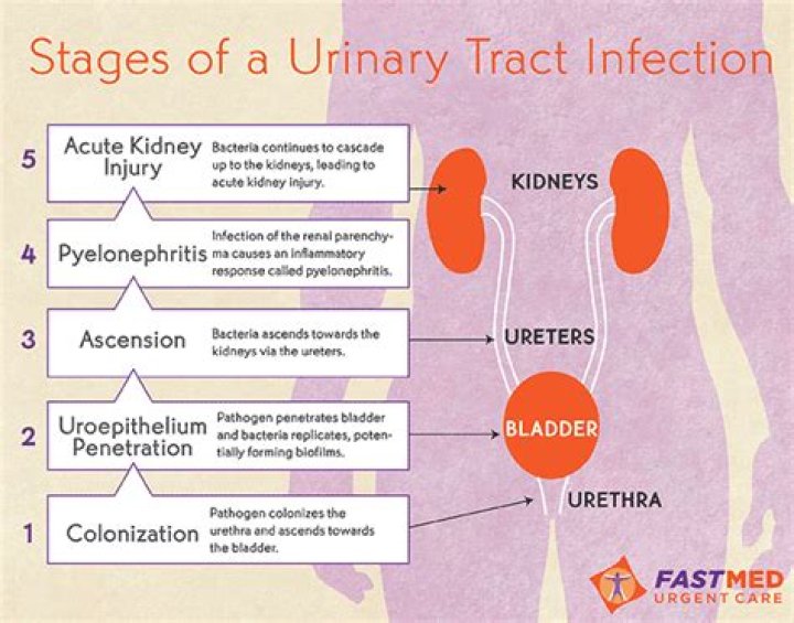 How long does a minor UTI last?