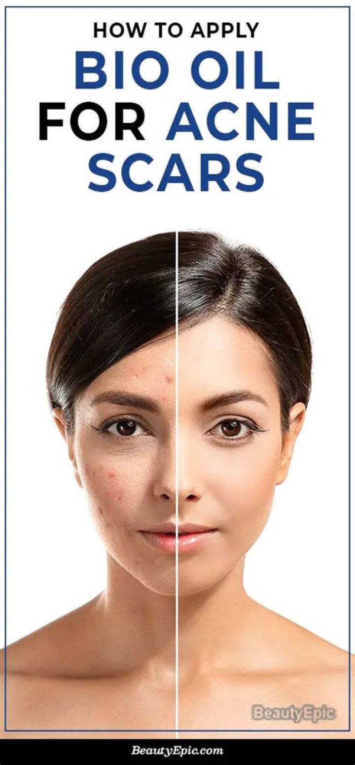 How long does Bio-Oil take to work on scars?