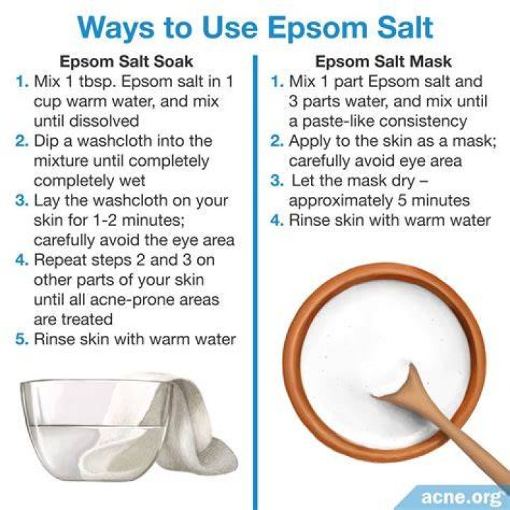 How long does Epsom salt take to work?