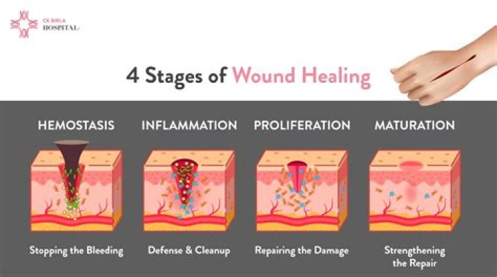 How long should a wound ooze?