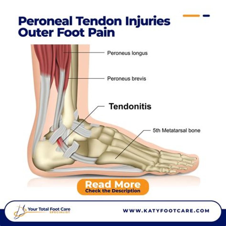How painful is a torn tendon?