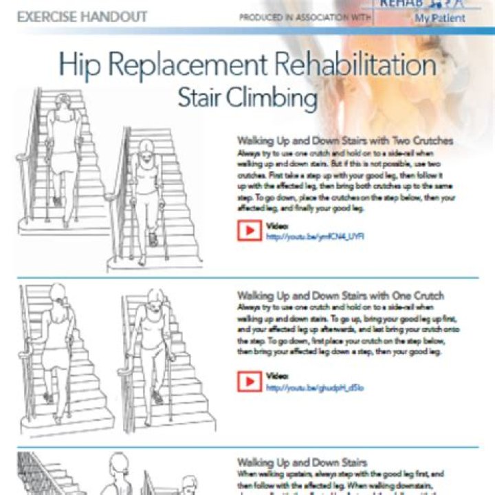 Is Climbing stairs good exercise after hip replacement?