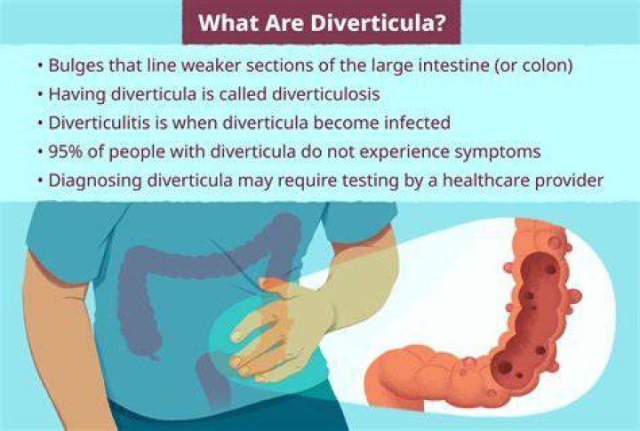 Is diverticulitis worse in the morning?