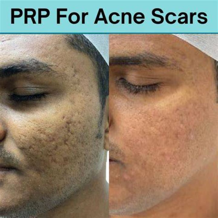 Is Eucerin good for scars?