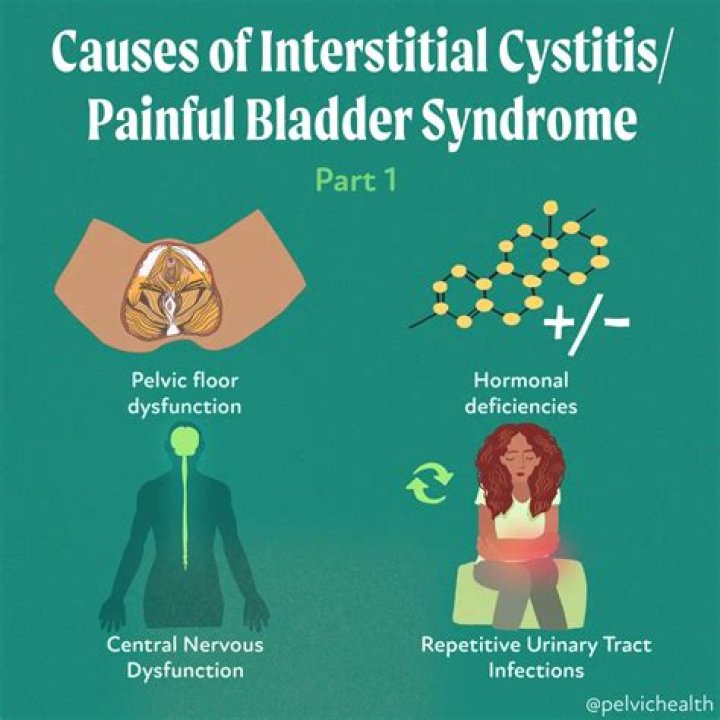 Is interstitial cystitis related to fibromyalgia?