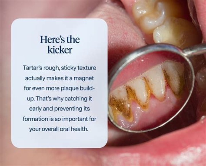 Is it tartar or my tooth?