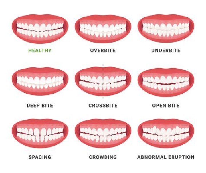 Is it too late for my teeth?