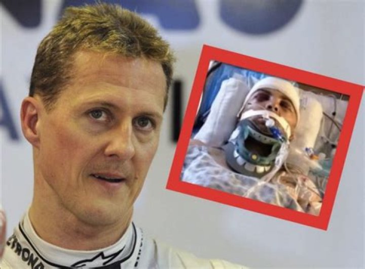 Is Michael Schumacher brain damaged?