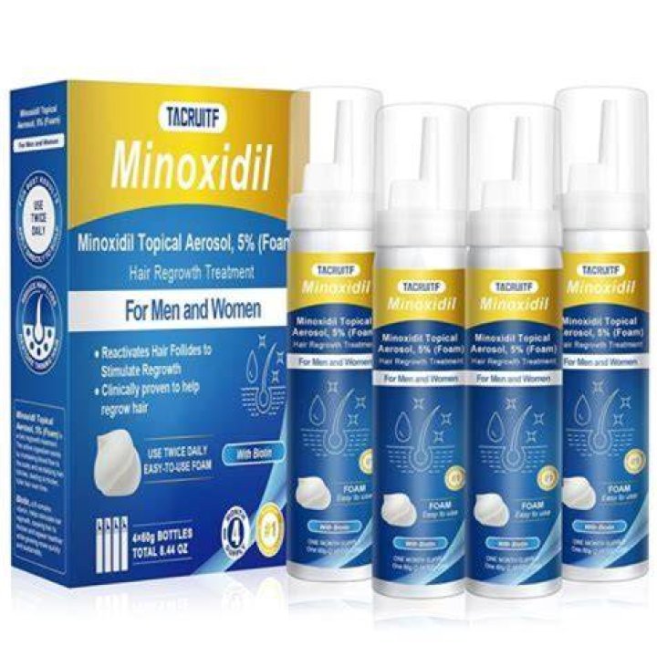 Is minoxidil a lifelong treatment?
