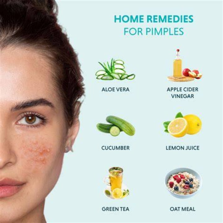Is Myra E good for pimples?