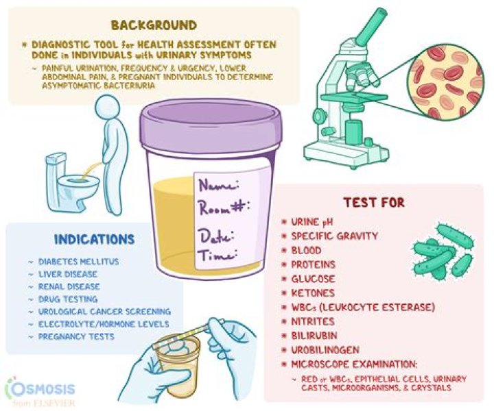Is there urine in DEF?