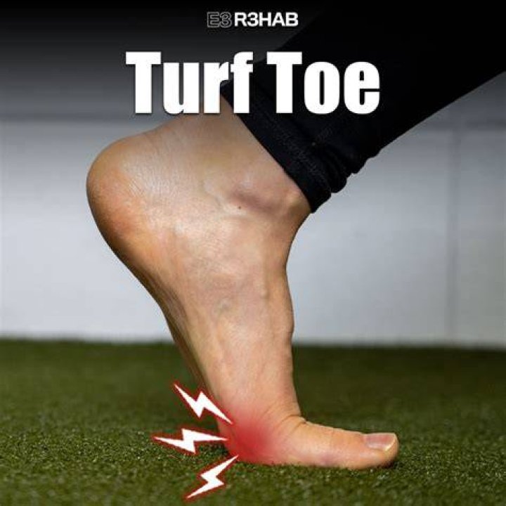 Is turf bad for athletes?