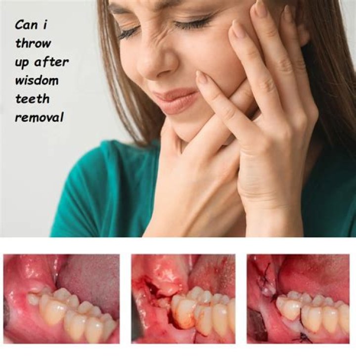Is wisdom teeth removal scary?