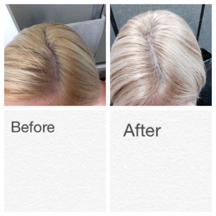 Should I shampoo my hair after bleaching?